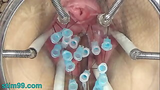 Extreme German BDSM Needles inner Pussy Cervix and Pair